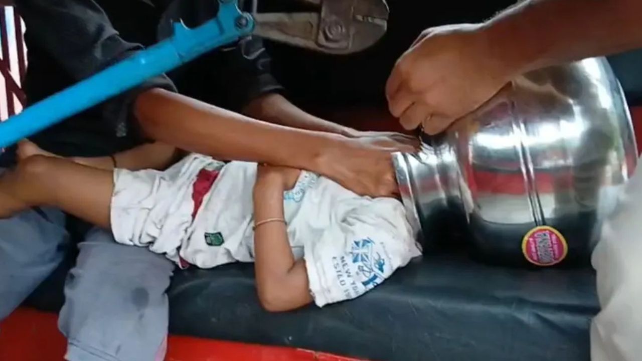 Odisha: बर्तन में फंसा मासूम का सिर, दमकल कर्मियों ने दो घंटे की मशक्कत से बचाई जान