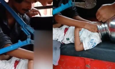 Odisha: बर्तन में फंसा मासूम का सिर, दमकल कर्मियों ने दो घंटे की मशक्कत से बचाई जान