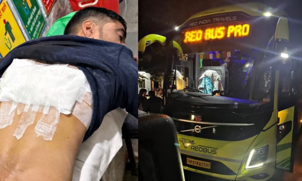 ओवरटेक विवाद में थार सवारों का हमला, बस स्टाफ पर चाकू और फायरिंग